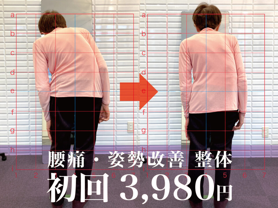 側湾症・姿勢改善