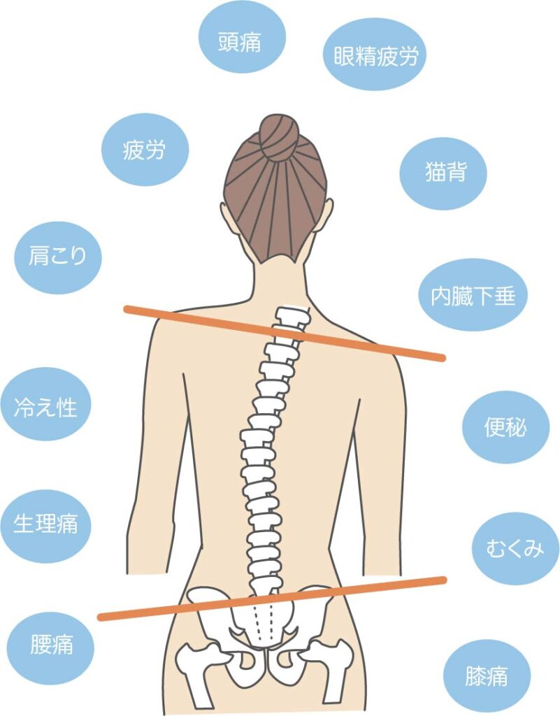 姿勢の乱れが原因で起こる体の不調（頭痛・肩こり・腰痛・便秘・冷え性など）のイラスト図解