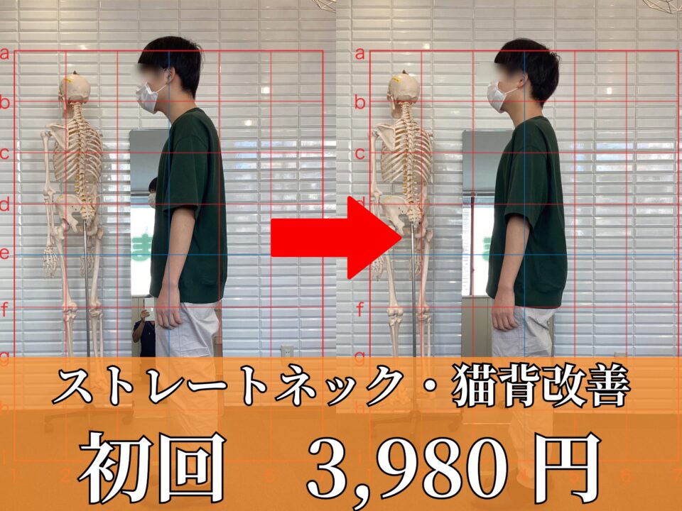 ストレートネック、猫背改善