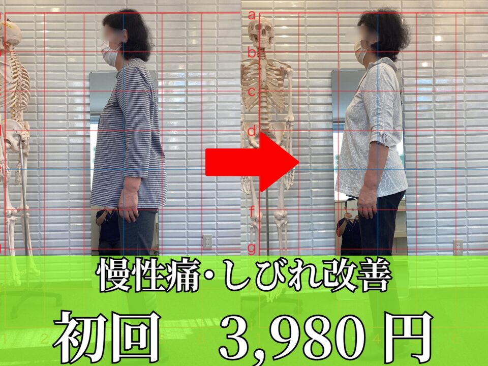 脊柱管狭窄症、ヘルニア、坐骨神経痛改善
