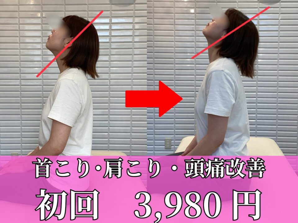 首こり・肩こり・頭痛改善