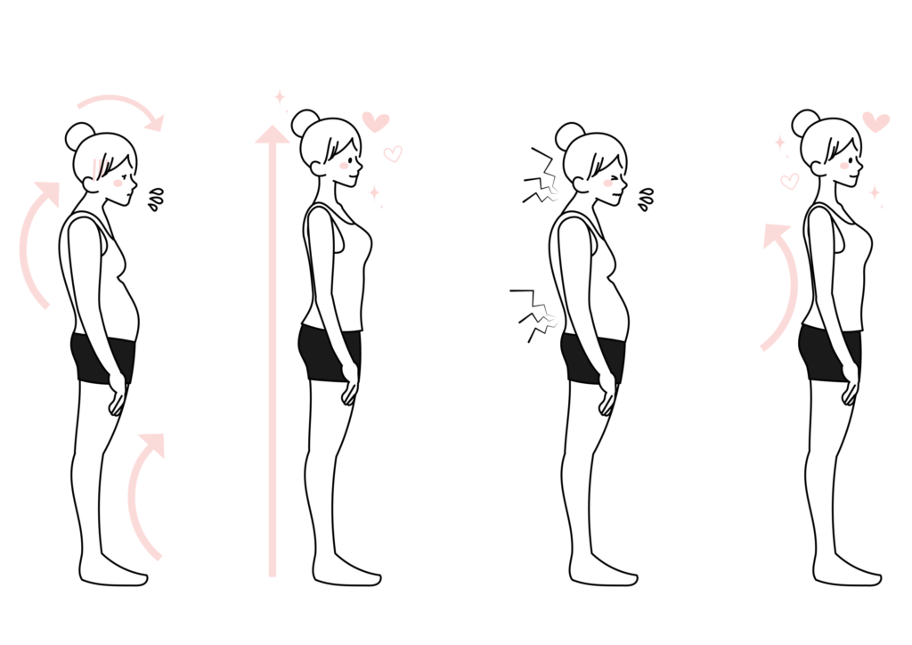 姿勢改善のビフォーアフターを示すイラスト。猫背や反り腰から正しい姿勢に変化する様子。鹿児島市のまどか整体院では、側弯症や不良姿勢に合わせた整体サポートを提供しています
